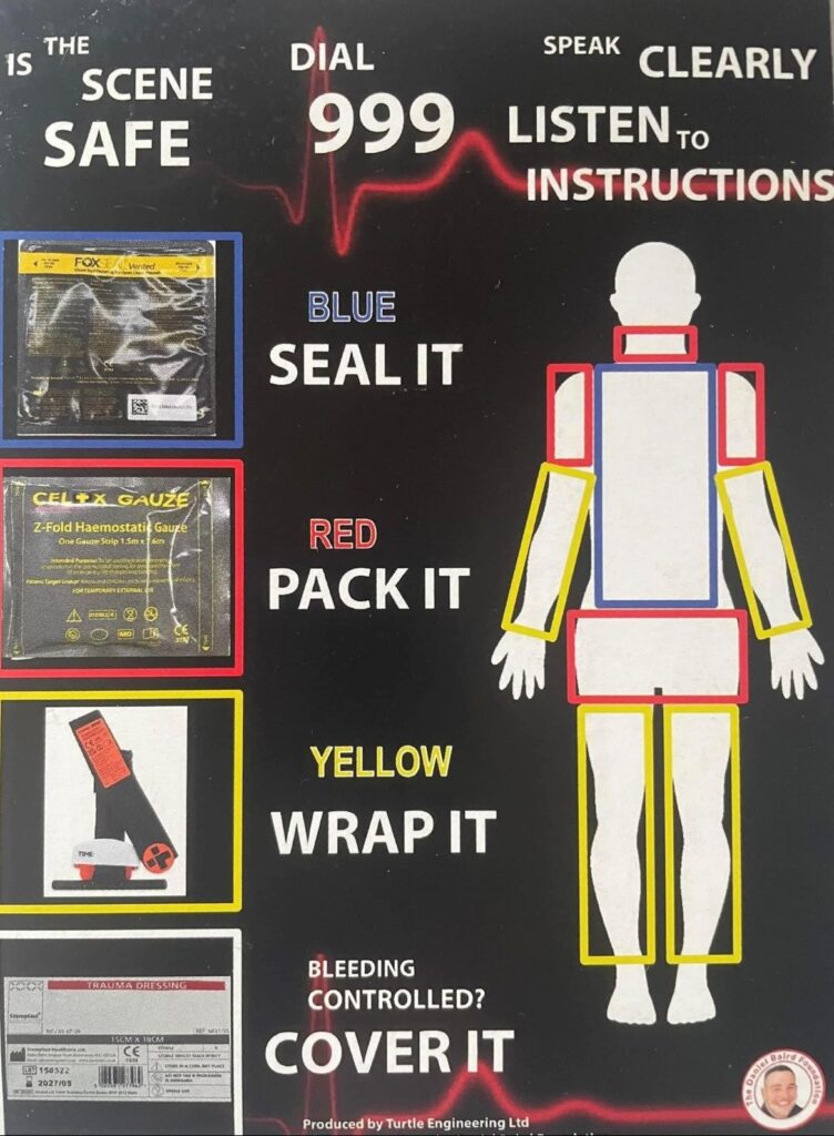 kit instructions